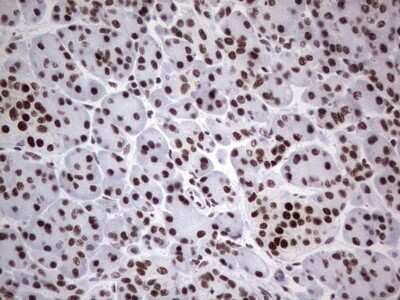 Immunohistochemistry: HDAC9 Antibody (OTI7G2) - Azide and BSA Free [NBP2-71493]