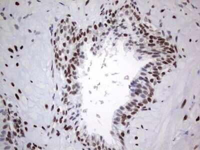 Immunohistochemistry: HDAC9 Antibody (OTI7G2) - Azide and BSA Free [NBP2-71493]