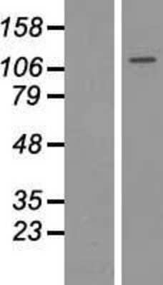 Western Blot: HDAC9 Overexpression Lysate [NBL1-11486]