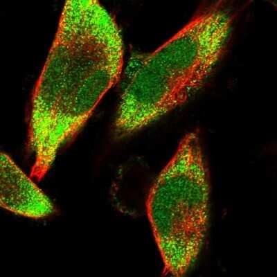Immunocytochemistry/ Immunofluorescence: HDDC3 Antibody [NBP1-82684]