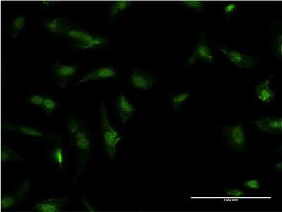Immunocytochemistry/ Immunofluorescence: HDGF Antibody (2D6) [H00003068-M09]
