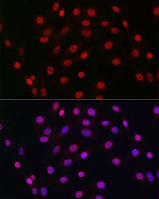 Immunocytochemistry/ Immunofluorescence: HDGF Antibody (5U7A7) [NBP3-15281]