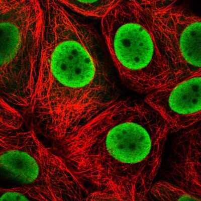 Immunocytochemistry/ Immunofluorescence: HDGF Antibody [NBP2-38589]