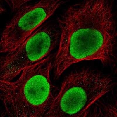 Immunocytochemistry/ Immunofluorescence: HDGF Antibody [NBP2-38701]