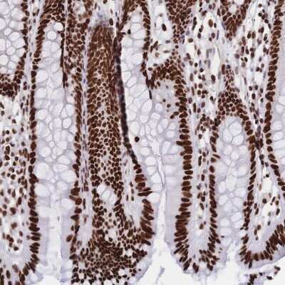 Immunohistochemistry: HDGF Antibody [NBP2-38589]