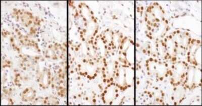Immunohistochemistry-Paraffin: HDGF Antibody [NBP1-71924]