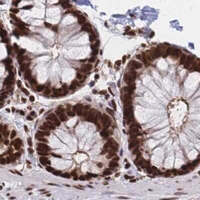 Immunohistochemistry-Paraffin: HDGF Antibody [NBP2-38701]