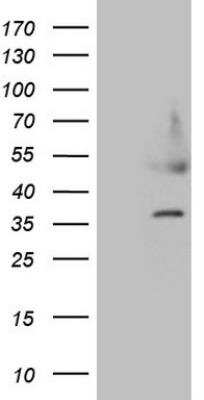 Western Blot: HDGF Antibody (OTI8C7) [NBP2-45953]