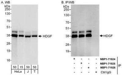 Western Blot: HDGF Antibody [NBP1-71925]
