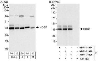 Western Blot: HDGF Antibody [NBP1-71926]