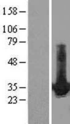 Western Blot: HDGF Overexpression Lysate [NBL1-11488]