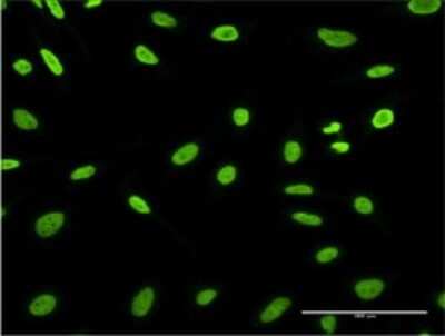 Immunocytochemistry/ Immunofluorescence: HDGFRP3 Antibody (1D1) [H00050810-M02]