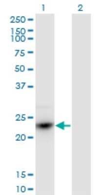Western Blot: HDGFRP3 Antibody (1D1) [H00050810-M02]
