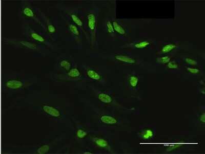 Immunocytochemistry/ Immunofluorescence: HDGFRP3 Antibody [H00050810-B02P]