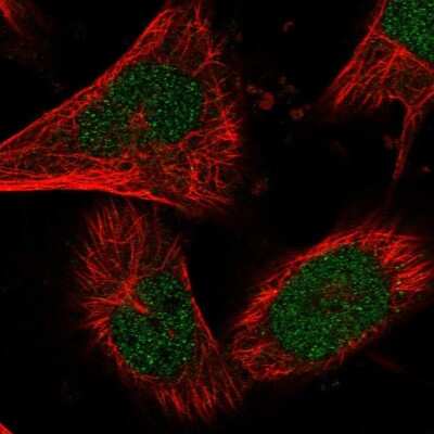 Immunocytochemistry/ Immunofluorescence: HDGFRP3 Antibody [NBP2-13246]