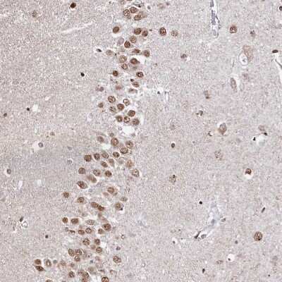 Immunohistochemistry-Paraffin: HDGFRP3 Antibody [NBP2-13246]