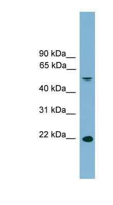 Western Blot: HDGFRP3 Antibody [NBP1-79645]