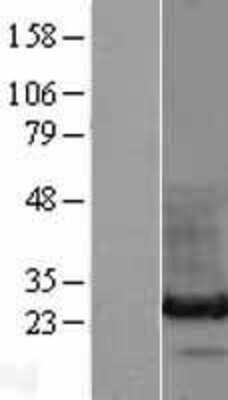 Western Blot: HDGFRP3 Overexpression Lysate [NBL1-11490]