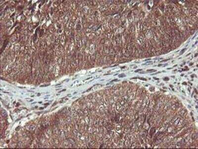 Immunohistochemistry-Paraffin: HDHD1A Antibody (OTI7A2) [NBP2-00487]