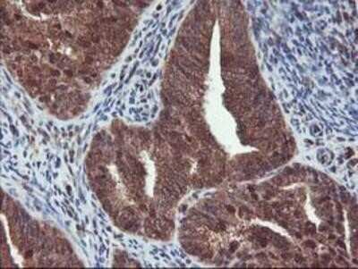 Immunohistochemistry: HDHD1A Antibody (OTI7A2) - Azide and BSA Free [NBP2-71368]