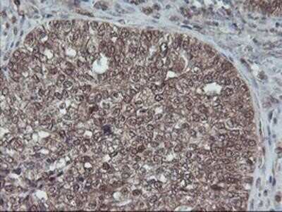 Immunohistochemistry: HDHD1A Antibody (OTI7A2) - Azide and BSA Free [NBP2-71368]