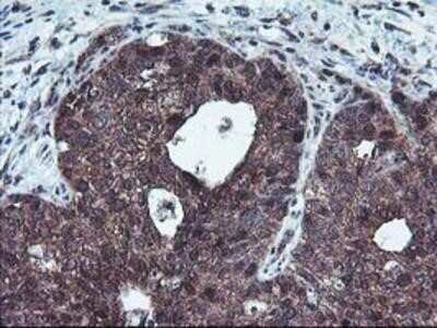 Immunohistochemistry: HDHD1A Antibody (OTI7A2) - Azide and BSA Free [NBP2-71368]