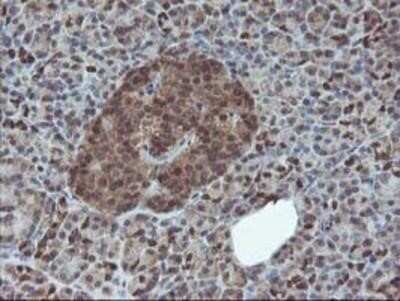 Immunohistochemistry: HDHD1A Antibody (OTI7A2) - Azide and BSA Free [NBP2-71368]