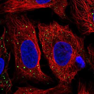 Immunocytochemistry/ Immunofluorescence: HDHD2 Antibody [NBP2-31799]