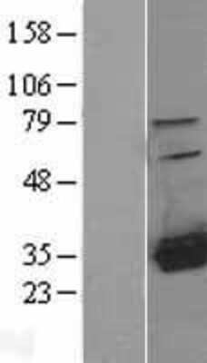 Western Blot: HDHD2 Overexpression Lysate [NBL1-11492]