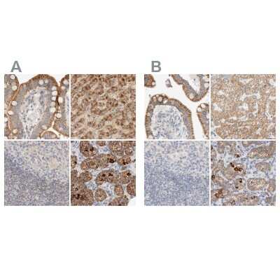 Immunohistochemistry-Paraffin: HDHD3 Antibody [NBP1-86706]