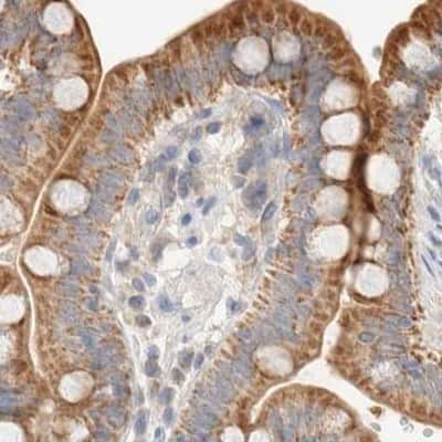 Immunohistochemistry-Paraffin: HDHD3 Antibody [NBP1-86706]