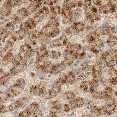 Immunohistochemistry-Paraffin: HDHD3 Antibody [NBP1-86706]