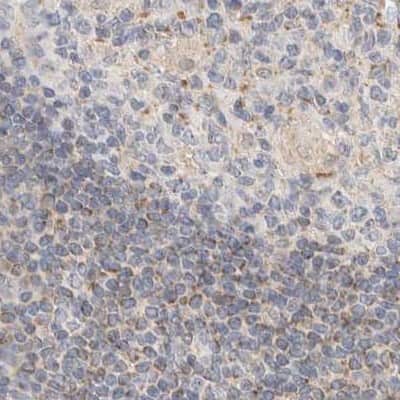 Immunohistochemistry-Paraffin: HDHD3 Antibody [NBP1-86706]
