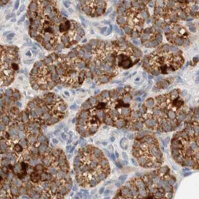 Immunohistochemistry-Paraffin: HDHD3 Antibody [NBP1-86706]