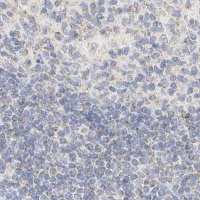 Immunohistochemistry-Paraffin: HDHD3 Antibody [NBP1-86707]