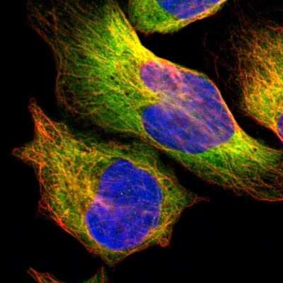 Immunocytochemistry/ Immunofluorescence: HDJ2 Antibody [NBP1-88019]