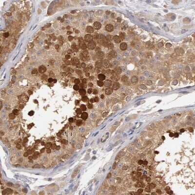 Immunohistochemistry-Paraffin: HDJ2 Antibody [NBP1-88019]