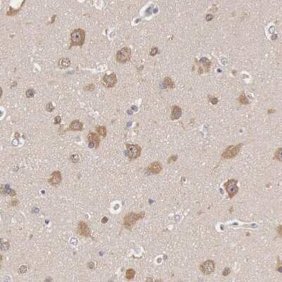 Immunohistochemistry-Paraffin: HDJ2 Antibody [NBP1-88019]