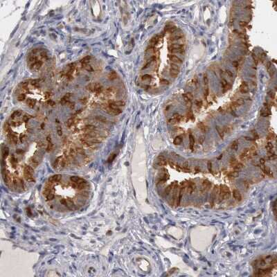 Immunohistochemistry-Paraffin: HDJ2 Antibody [NBP1-88019]