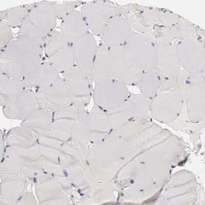 Immunohistochemistry-Paraffin: HDJ2 Antibody [NBP1-88019]
