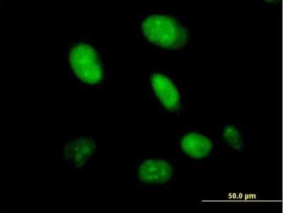 Immunocytochemistry/ Immunofluorescence: HDX Antibody [H00139324-B01P]