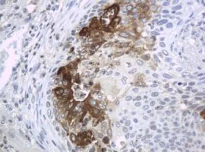 Immunohistochemistry: HE4/WFDC2 Antibody (OTI1E12) [NBP2-46360]