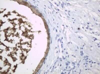 Immunohistochemistry: HE4/WFDC2 Antibody (OTI1E12) - Azide and BSA Free [NBP2-71599]