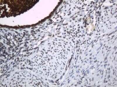 Immunohistochemistry: HE4/WFDC2 Antibody (OTI1E12) - Azide and BSA Free [NBP2-71599]