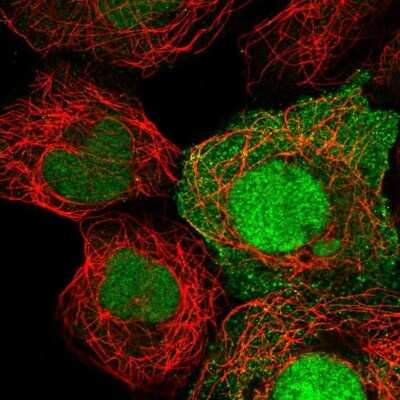 Immunocytochemistry/ Immunofluorescence: HEATR3 Antibody [NBP2-56248]