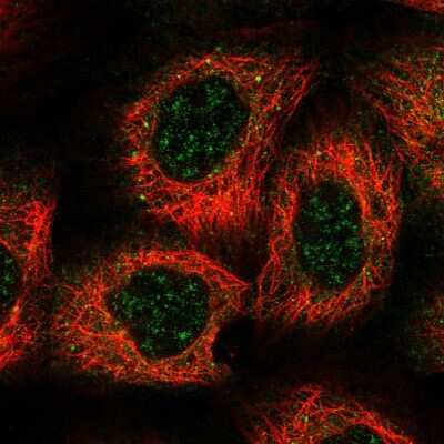 Immunocytochemistry/ Immunofluorescence: HEATR5B Antibody [NBP2-55762]