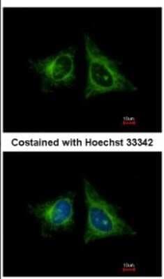 Immunocytochemistry/ Immunofluorescence: HEBP1 Antibody [NBP2-14977]