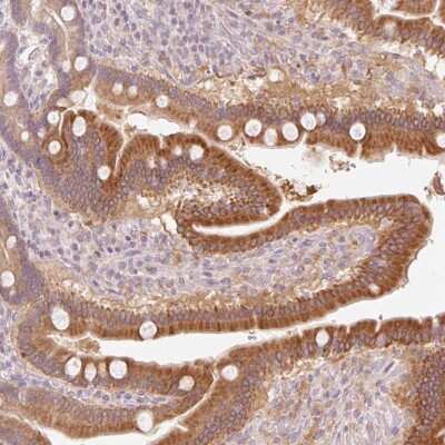 Immunohistochemistry: HEBP1 Antibody [NBP2-49224]