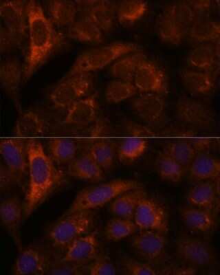 Immunocytochemistry/ Immunofluorescence: HEBP2 Antibody - Azide and BSA Free [NBP3-04517]