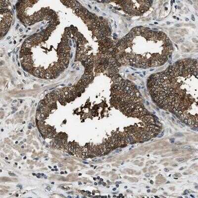 Immunohistochemistry-Paraffin: HEBP2 Antibody [NBP1-86747]